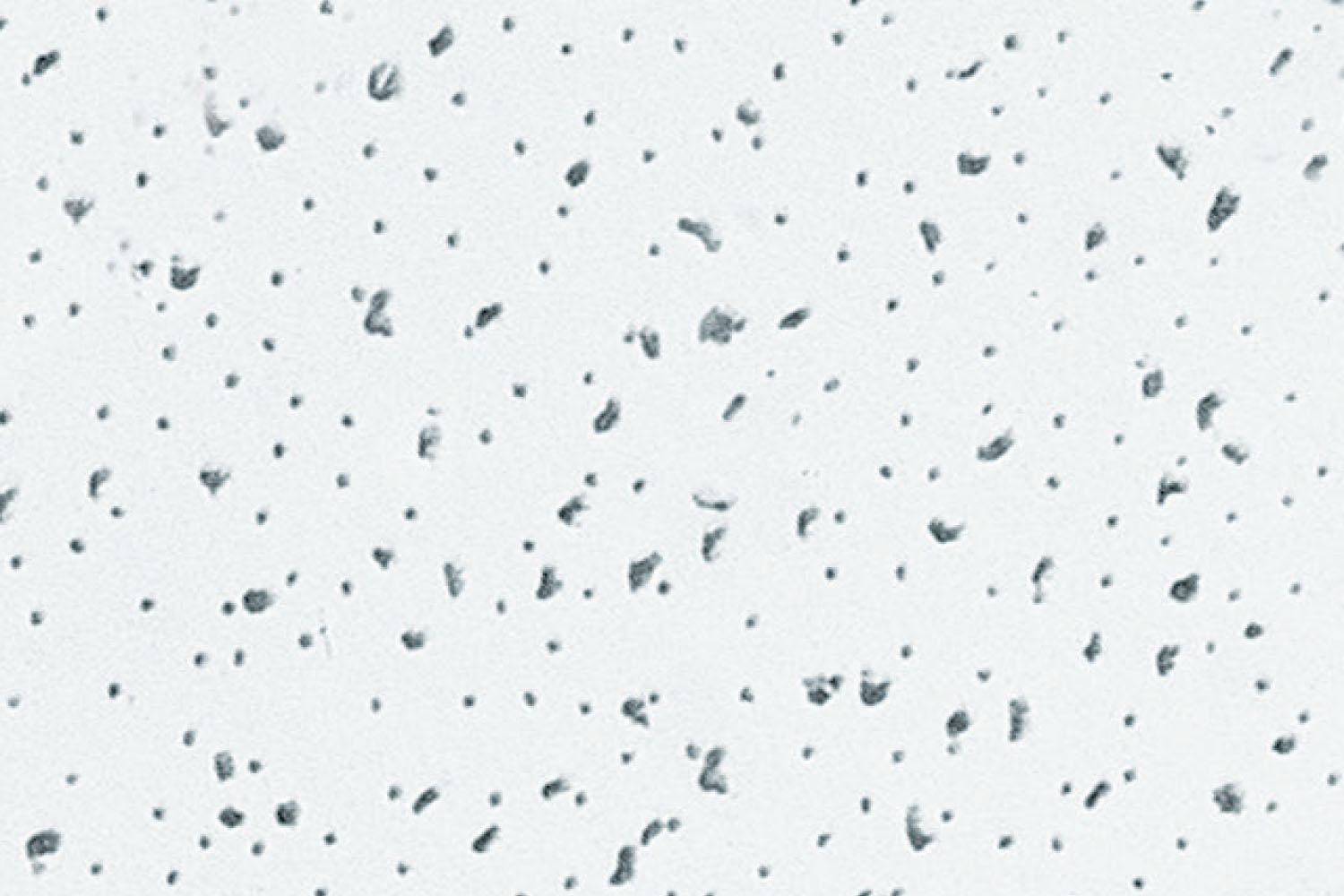 أسقف رادار سيراميك™ الصوتية